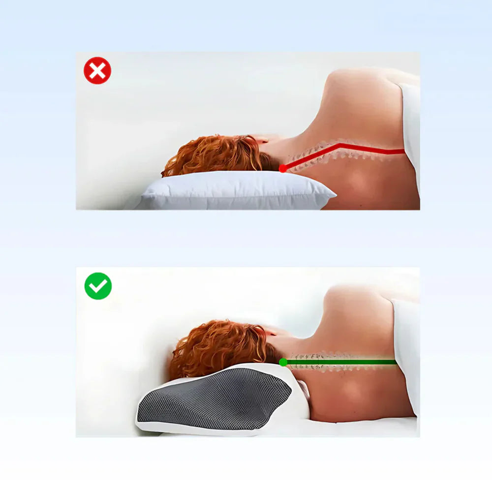 SanaSleep™ Ergonomisch Kussen